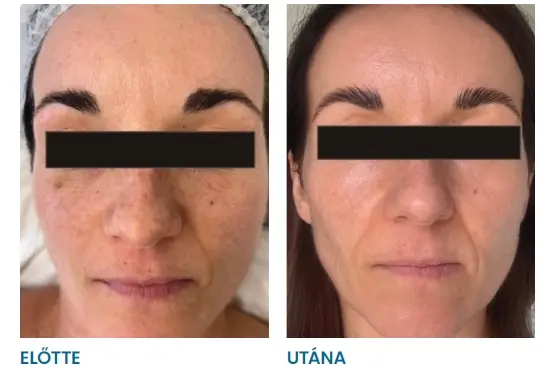 elotteutana2
