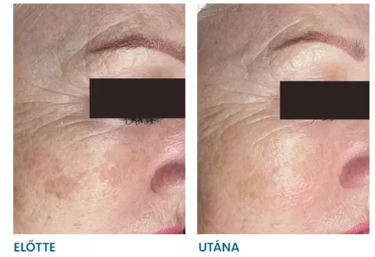 elotteutana3